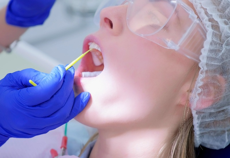 Fluoride treatment is applied to strengthen teeth during a dental visit in Trenton, MI